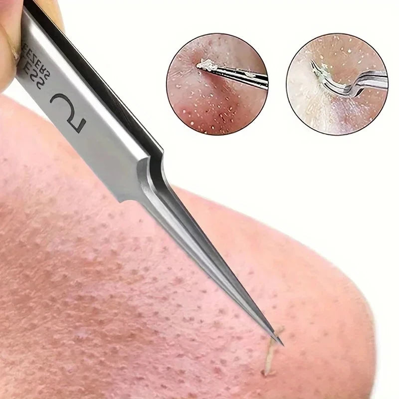 1Pc Extra Fine No. 5 Cellular Acne Blackhead Tweezers - Facial Beauty Remove Acne Needle Tools for Skin Care Tool