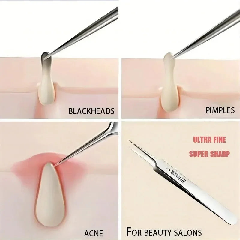 1Pc Extra Fine No. 5 Cellular Acne Blackhead Tweezers - Facial Beauty Remove Acne Needle Tools for Skin Care Tool